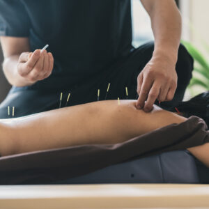 Acupuntura Raw Yoga Studio