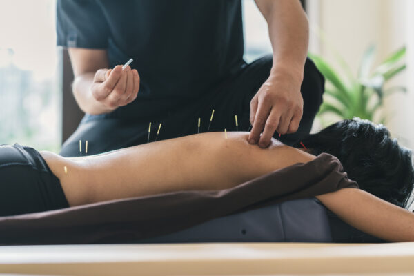 Acupuntura Raw Yoga Studio